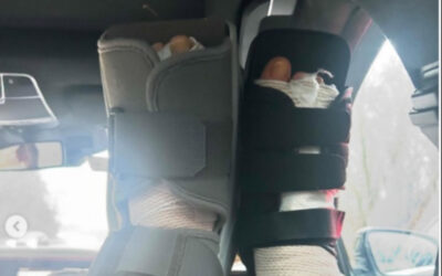 Lara Spencer undergoes double foot surgery