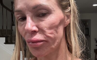 Several weeks and $112k later, Brandi Glanville still doesn’t have an answer for her mystery health condition